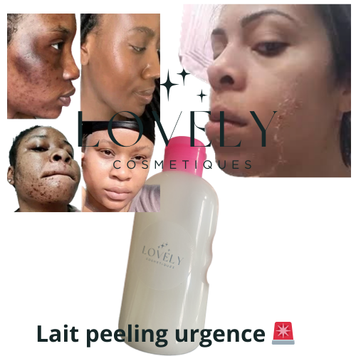 Lait peeling urgence 🚨